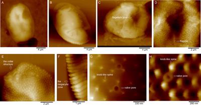 Nanostructure and Nanomechanics of Prorocentrum donghaiense and Their Changes Under Nitrogen Limitation by Atomic Force Microscopy